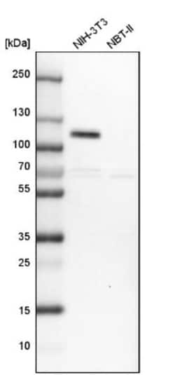 DOC1 Antibody, Novus Biologicals 25 &mu;L; Unlabeled:Antibodies, Polyclonal